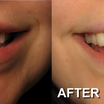 Jerrold Goldsmith, DDS FAGD - Cosmetic Dentists Near Me - Indianapolis, Indiana Jerrold Goldsmith, DDS FAGD - Cosmetic Dentists Near Me - Indianapolis, Indiana