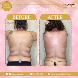Inscape Body Aesthetics