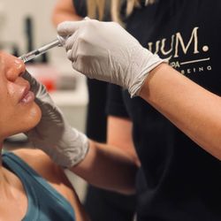 Tulum Wellness Spa - Cheek and Lip Filler