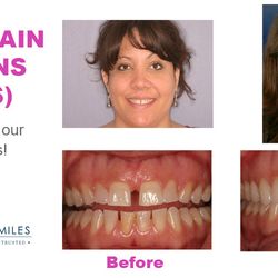 Orange City Dentist- Universal Smiles Dentistry - Another one of our happy clients!
