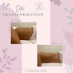 Detox & Relax Lymphatic By Juliana - Lymphatic Drainage before x after