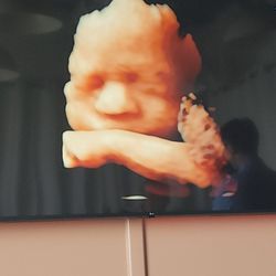 Bay Area 4D Ultrasound LLC