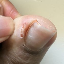 Nails Organic Spa - Cut toe