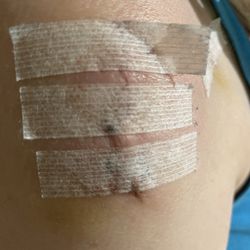Quest Diagnostics - Just one of my injuries.