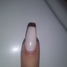My once bright white nails turned to brown.