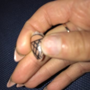 3D Nails-By-Fiza - After barely two weeks. Using a bandage and hoping to get it but not now after her bad attitude - Nail Salons Near Me - London, XGL