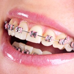 Northeast Orthodontics - Your smile is important to us!