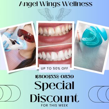 Angel Wings - Teeth Whitening Discount - Laboratory Testing Near Me - Plantation, Florida Angel Wings - Teeth Whitening Discount - Laboratory Testing Near Me - Plantation, Florida