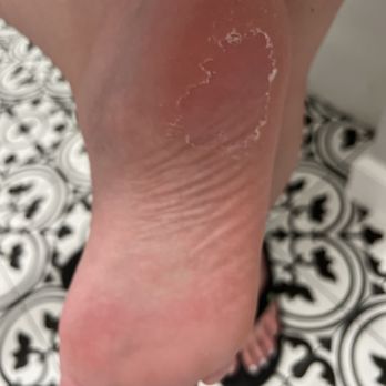 Lee Spa Nails - Leftover callous same night - Nail Salons Near Me - Corona, California Lee Spa Nails - Leftover callous same night - Nail Salons Near Me - Corona, California