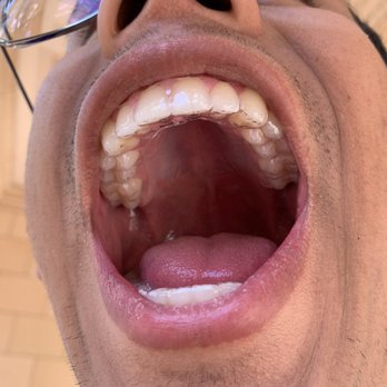 Just Smile Orthodontics - New retainers - Orthodontists Near Me - Tucson, Arizona Just Smile Orthodontics - New retainers - Orthodontists Near Me - Tucson, Arizona