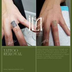 Inglewood Laser & Aesthetics Plus
