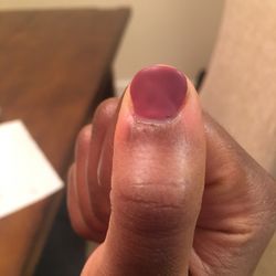 Nail Addict - Finger that was cut during my manicure