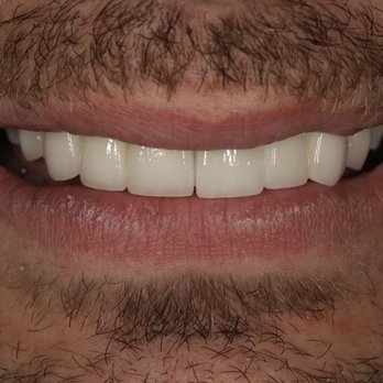 Makeover Dental Studio - Smile Makeover - Orthodontists Near Me - Tijuana, BCN Makeover Dental Studio - Smile Makeover - Orthodontists Near Me - Tijuana, BCN