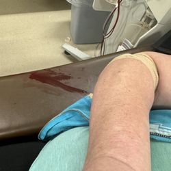 Biolife Plasma Services - Bio life's finest nurses and their crappy IV work