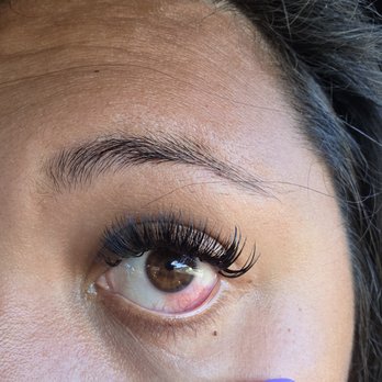 Soleil Lash - A picture of my right eye irritated and red. - Eyelash Service Near Me - Fullerton, California