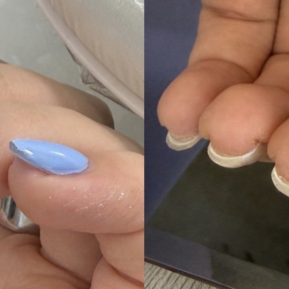 Zen Nail Lounge - Uneven coat and thick layer of builder gel - Nail Salons Near Me - Montebello, California Zen Nail Lounge - Uneven coat and thick layer of builder gel - Nail Salons Near Me - Montebello, California