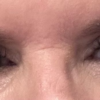 K & M Nails & Lashes - Day after fill eyes open. - Waxing Near Me - Las Vegas, Nevada K & M Nails & Lashes - Day after fill eyes open. - Waxing Near Me - Las Vegas, Nevada