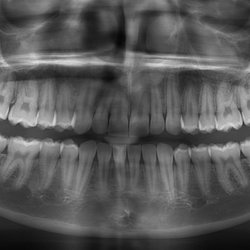 Desert Ridge Implant & Oral Surgery