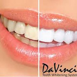 MesmerEyes Lash and Brow Boutique - Professional teeth whitening by Amy