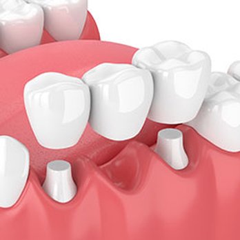 Laws Family Dentistry - General Dentistry Near Me - Glendale, Arizona Laws Family Dentistry - General Dentistry Near Me - Glendale, Arizona