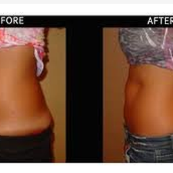 OC Body Contouring and Med Spa
