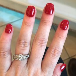 You can see that my cuticles are red and this is just one hand. You can see that my cuticles are red and this is just one hand.