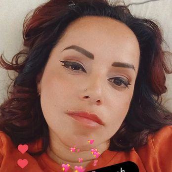 Medspa Deluxe LA - Perfection my lips  so happy - Skin Care Near Me - Rancho Cucamonga, California