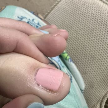 Jupiter Nails and Spa - She clipped them so short to the point they almost bled - Nail Salons Near Me - Jupiter, Florida Jupiter Nails and Spa - She clipped them so short to the point they almost bled - Nail Salons Near Me - Jupiter, Florida