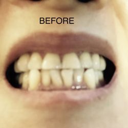 The Brace Place & Kids Dentistry