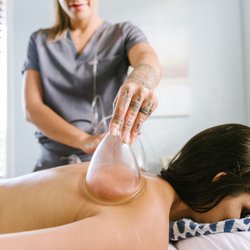 Nina Hamid Acupuncture - Medicupping Vacuum Therapy