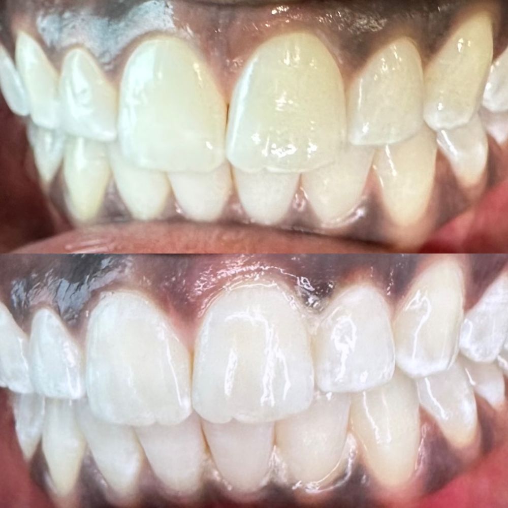 Pearly Whites Lab Htx Logo