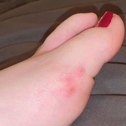 cut on my foot from the sponge, a couple hours after my pedicure. it was bleeding when it happened. cut on my foot from the sponge, a couple hours after my pedicure. it was bleeding when it happened.
