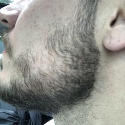 My cheek just grows in like that, but that's the line Ed left on one side. My cheek just grows in like that, but that's the line Ed left on one side.