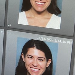 Bucky Plastic Surgery: Louis P. Bucky, MD, FACS
