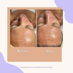 Glow to Go Durango - Fire & Ice Facial