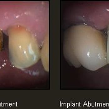 Cary N. Goldstein, DDS - Oral Surgeons Near Me - Wickliffe, Ohio