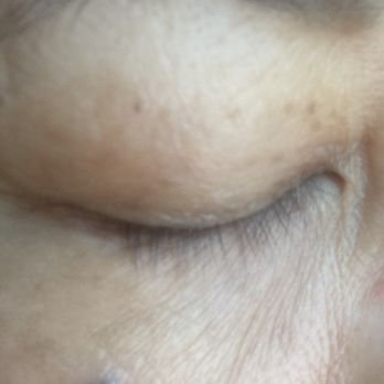 Eye Makeovers - Before - Permanent Makeup Near Me - Redondo Beach, California Eye Makeovers - Before - Permanent Makeup Near Me - Redondo Beach, California