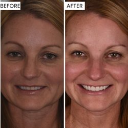 Weston Spencer, DDS Cosmetic Comprehensive Dentistry