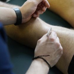 Health Centered Chiropractic - Rehab Technician scraping the muscles of a patient.