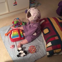 Hanger Clinic - She got used to the band quickly and was not bothered by it.
