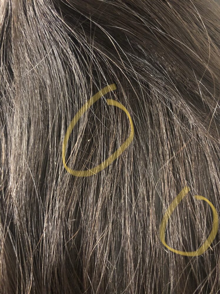 Lice Eggs Yelp