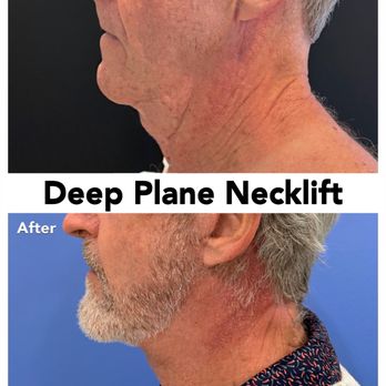 Michael D Mirmanesh, MD - Cosmetic Surgeons Near Me - Pinellas Park, Florida Michael D Mirmanesh, MD - Cosmetic Surgeons Near Me - Pinellas Park, Florida