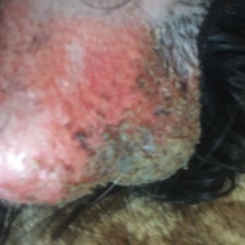 Associated Veterinary Specialists North - Razor burns left after AVS procedure on our boy. - Veterinarians Near Me - Bridgeton, Missouri Associated Veterinary Specialists North - Razor burns left after AVS procedure on our boy. - Veterinarians Near Me - Bridgeton, Missouri