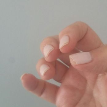 Top Hit Nails - My 5 day old acrylic overlay nails all chipped. - Nail Salons Near Me - Boca Raton, Florida Top Hit Nails - My 5 day old acrylic overlay nails all chipped. - Nail Salons Near Me - Boca Raton, Florida