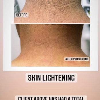 The Beauty Whisperer - Skin lightening - Medical Spas Near Me - Chino, California The Beauty Whisperer - Skin lightening - Medical Spas Near Me - Chino, California