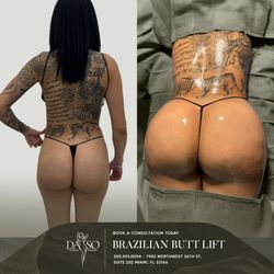 Daso Plastic Surgery - For many individuals, achieving a more sculpted, curvier silhouette is key to feeling confident and comfortable in their own skin. If you've