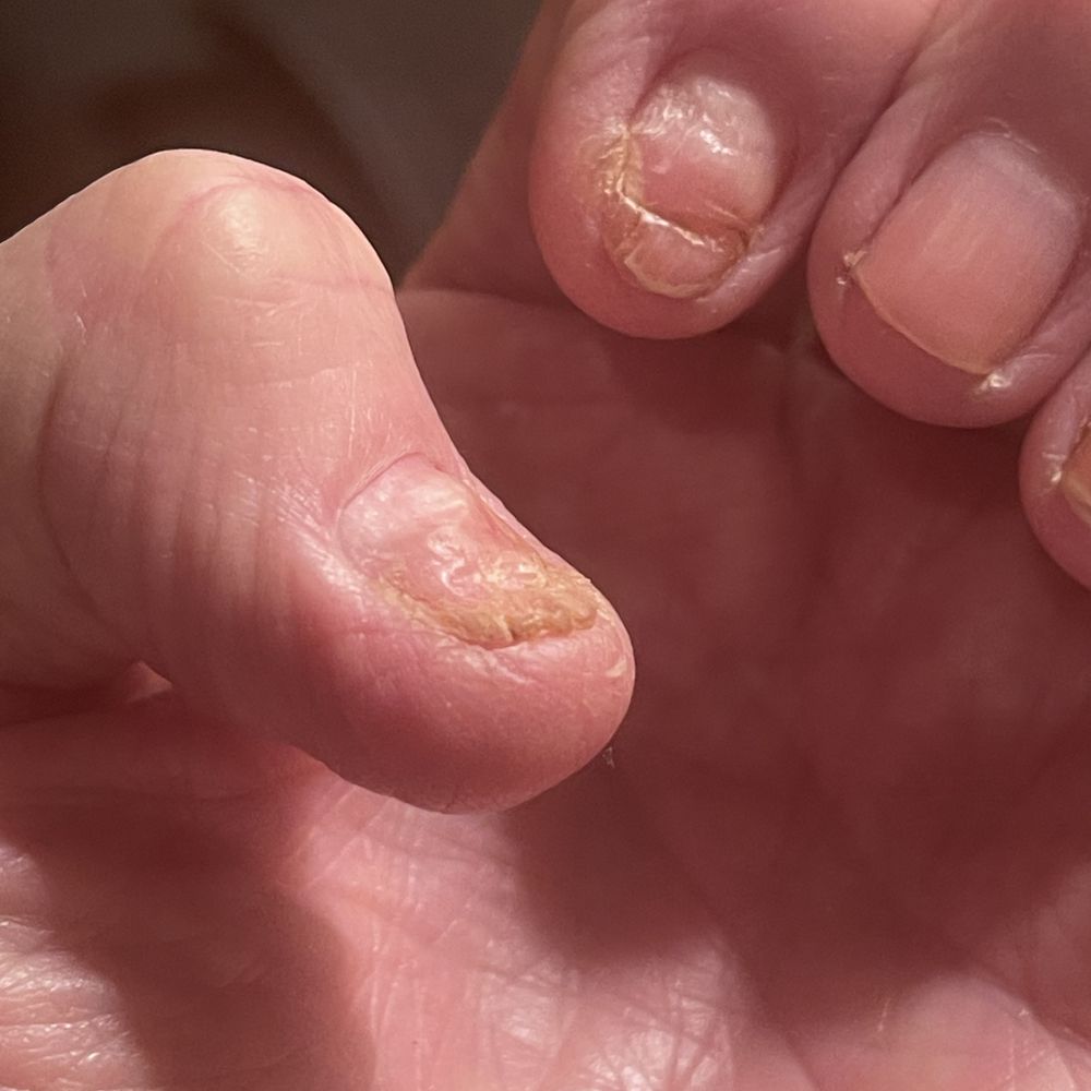 This shows both my thumb and index finger. This shows both my thumb and index finger.