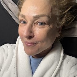 BP Royal Medspa - This was after my red light jelly facial