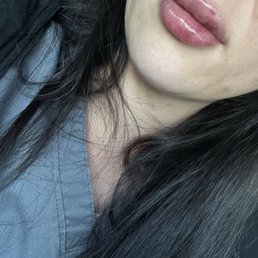 1 syringe 1 syringe