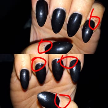 Kimberly Nails and Spa - All the scabs where Kim cut me with the sander!! - Nail Salons Near Me - Redondo Beach, California Kimberly Nails and Spa - All the scabs where Kim cut me with the sander!! - Nail Salons Near Me - Redondo Beach, California